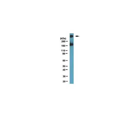 62-8369-39 Anti-SMRT, clone 1SM-1E7; 100 μL 04-1551