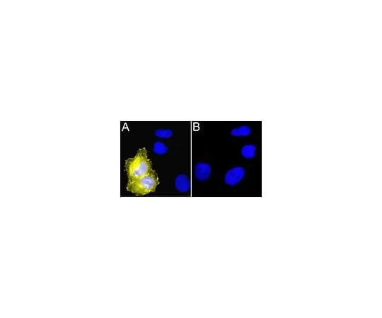 62-8392-44 Anti-Myc Tag, clone 4A6, Alexa Fluor(R) 555 conjugate; 100 μg 16-225