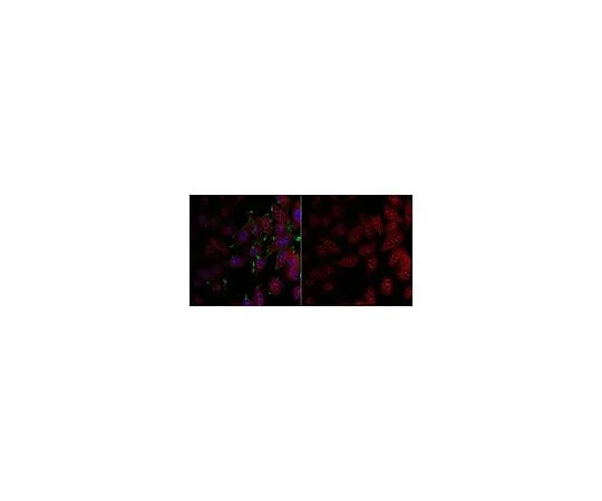 62-8467-89 Anti-LDHA ABN896