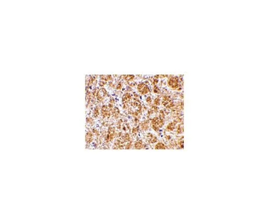 62-8467-63 Anti-DARC ABN495