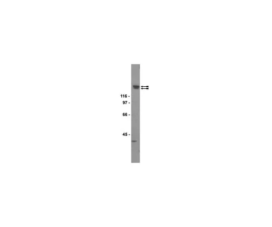 62-8371-72 Anti-KDR/Flk-1/VEGFR2, clone CH-11; 100 μg 05-554