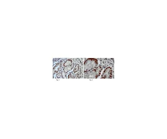 62-8465-66 Anti-DSCR3; 100 μg ABN87