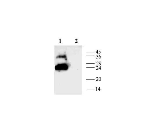 62-8447-61 Anti-Aquaporin 1; 200 μL AB3272-200UL