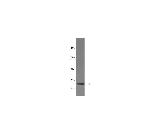 62-8382-51 Anti-Mn-SOD; 200 μg 06-984