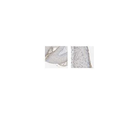 62-8458-39 Anti-Kallikrein-5/KLK5 ABC470