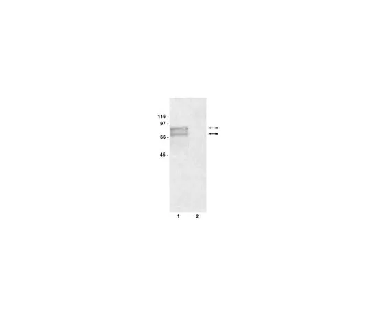 62-8372-21 Anti-Tyrosinase, clone T311; 200 μg 05-647