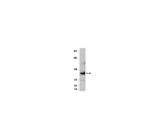 62-8385-75 Anti-Stargazin/Cacng2, CT; 100 μg 07-577