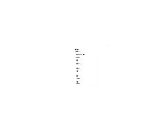 62-8464-01 Anti-UTX (KDM6A) ABE1865