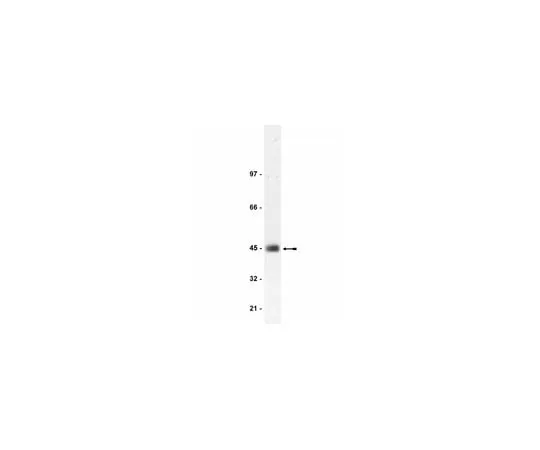 62-8372-19 Anti-CAR, clone RmcB; 200 μg 05-644