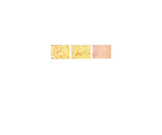 62-8453-93 Anti-Tyrosine Hydroxylase; 100 μg AB9983