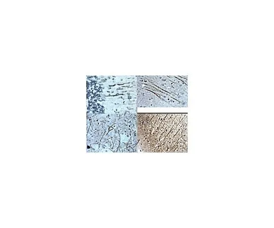 62-8455-84 Anti-Substance P Receptor, GPX-50UL AB15810