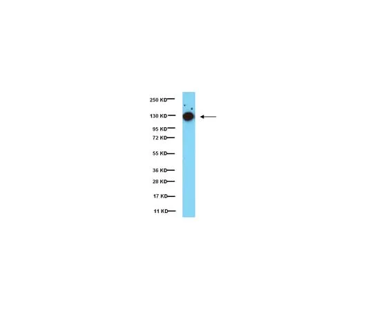 62-8374-35 Anti-phospho-Focal Adhesion Kinase (Tyr397), clone 18; 100 μg 05-1140