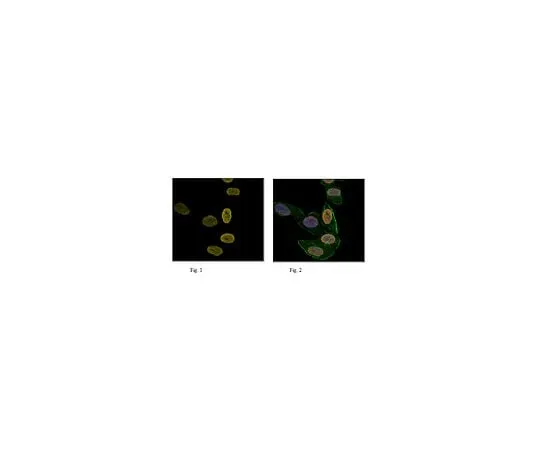 62-8385-19 Anti-trimethyl Histone H3 (Lys27), Alexa Fluor(R) 647 Conjugate 07-449-AF647