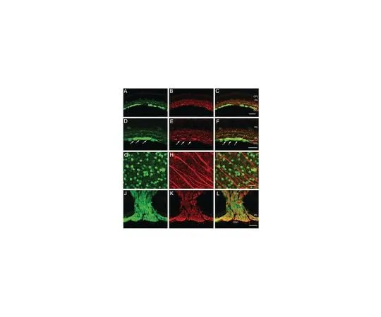 62-8453-10 Anti-Neurofilament L; 50 μL AB9568