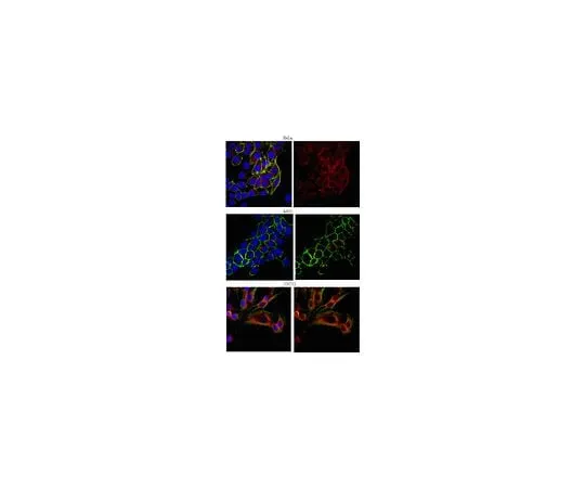 62-8388-41 Anti-EEA1; 100 μL 07-1820