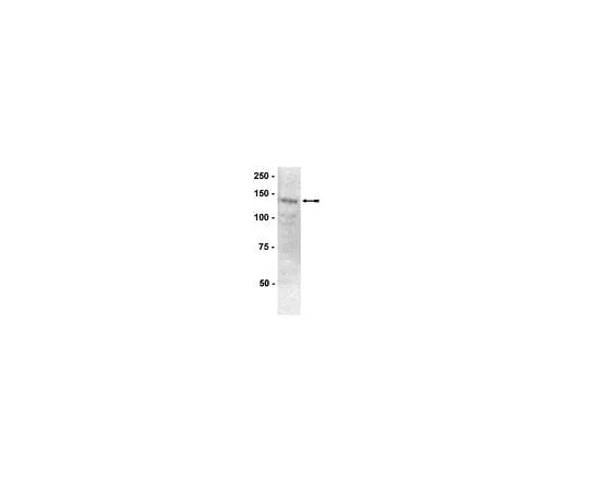 62-8385-31 Anti-PTPα; 100 μL 07-472