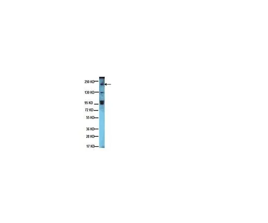 62-8381-63 Anti-erbB-2/HER-2; 200 μg 06-562