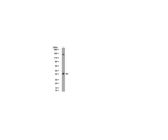 62-8383-14 Anti-SETD8 (hPR-SET7); 100 μL 06-1304