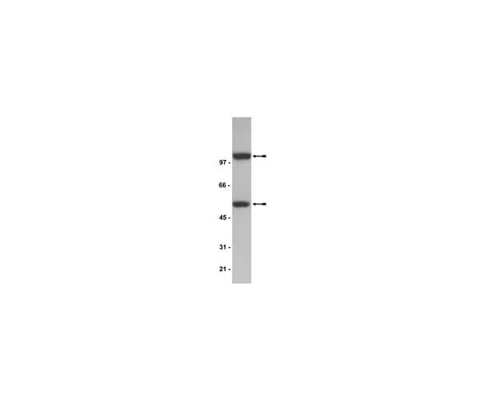 62-8370-84 Anti-NFκB p52; 200 μg 05-361
