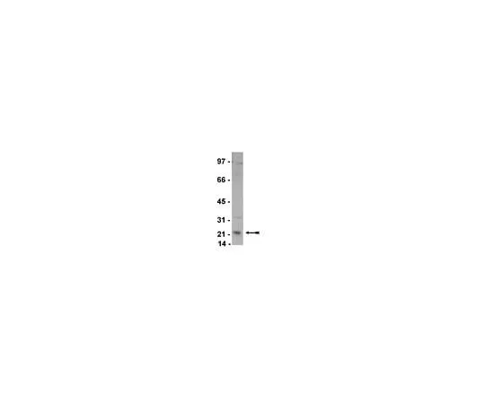 62-8386-11 Anti-Rab4; 100 μL 07-655