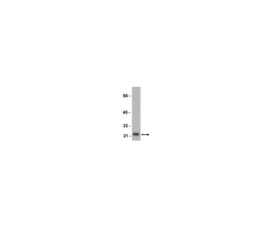 62-8372-89 Anti-Rho (-A, -B, -C), clone 55; 200 μg 05-778