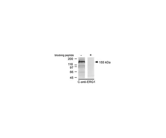 62-8451-97 Anti-Potassium Channel ERG1, C-terminus; 100 μg AB5930