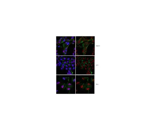 62-8459-47 Anti-Twist1 (Twist-related protein 1); 100 μg ABD29