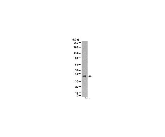62-8446-88 Anti-ATG3; 100 μg AB2953