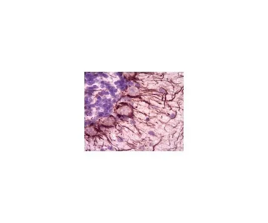62-8465-60 Anti-Neurofilament H (200 kDa); 100 μg ABN76