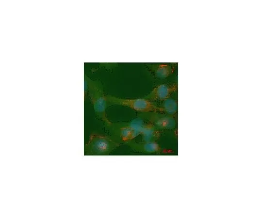 62-8444-80 Anti-phospho-ILK (Ser246); 100 μg AB1076