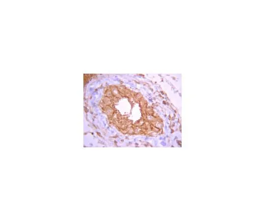 62-8387-18 Anti-PP2A, Catalytic subunit; 100 μL 07-1216