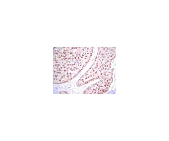62-8367-85 Anti-PTEN, clone 6H2.1 04-035