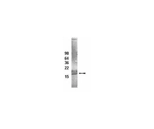 62-8391-69 UbcH8 Conjugating Enzyme; 100 μg 14-814