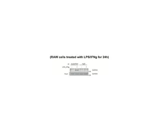 62-8388-78 Anti-acetyl GAPDH (Lys160) 7-84