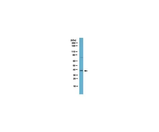 62-8383-35 Anti-SRp40; 100 μL 06-1365