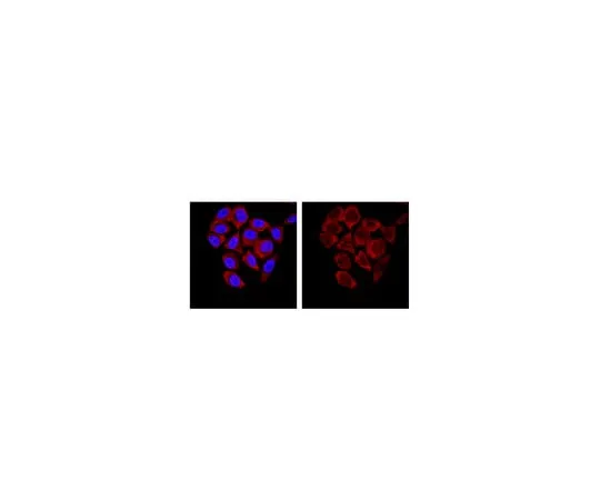 62-8369-11 Anti-SMN, clone 62E7; 100 μg 04-1466