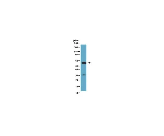 62-8387-84 Anti-Calcineurin pan A; 100 μL 07-1491