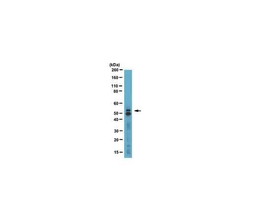 62-8387-60 Anti- GLUT-5, a.a. 490-502; 50 μL 07-1406