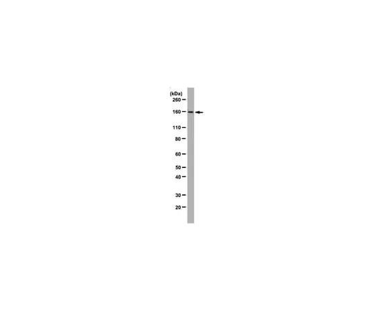 62-8369-34 Anti-Plk1-interacting checkpoint helicase (PICH), clone 142-26-3; 100 μg 04-1540