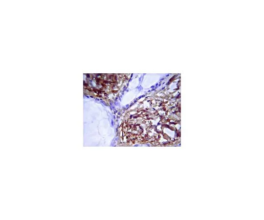 62-8444-54 Anti-Mo*** Collagen Type I; 100 μg AB765P