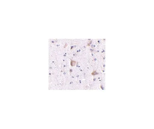 62-8467-78 Anti-RIM 2 ABN645