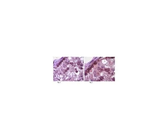 62-8461-30 Anti-DAZ; 100 μg ABE374