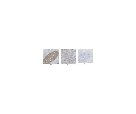62-8460-63 Anti-MLL2 (C-Term) ABE206