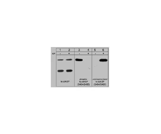 62-8446-14 Anti-N-WASP; 100 μL AB1963