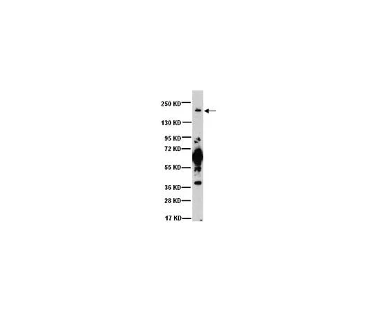 62-8448-10 Anti-Sodium, Potassium, Chloride Cotransporter 1; 50 μg AB3560P