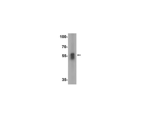 62-8467-40 Anti-TFEB ABN472