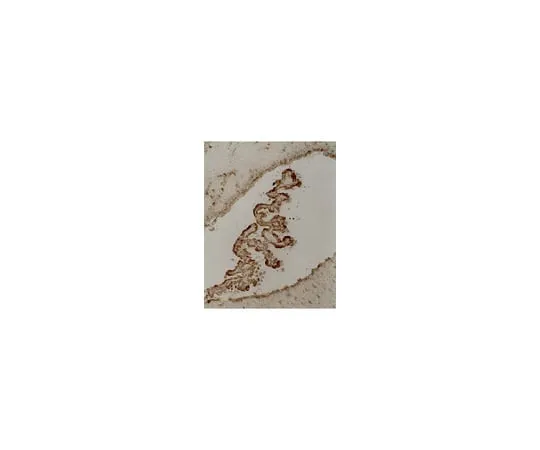 62-8370-81 Anti-Tau, clone 5E2; 200 μg 05-348