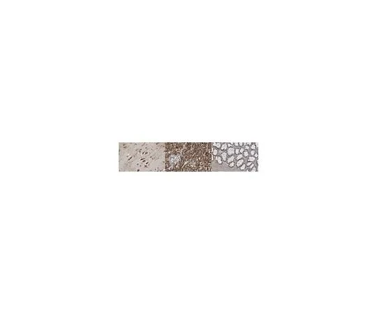 62-8463-70 Anti-60S Ribosomal Protein L26 ABE1438