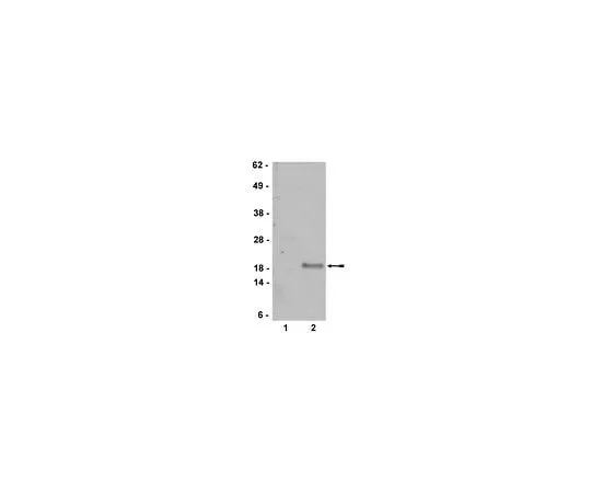 62-8385-62 Anti-p19 ARF; 200 μL 07-543