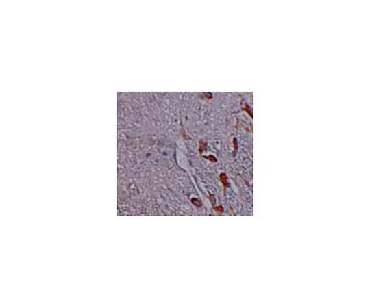 62-8467-75 Anti-LRRTM1 ABN642